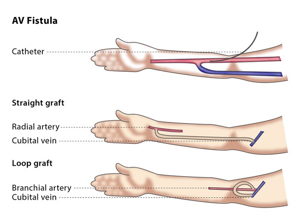 Varicose Veins Doctor in Jaipur, Spider Veins Specialist in Jaipur, Best Thyroid Ablation Specialist in Jaipur, Uterine Fibroid Treatment in Jaipur, Fibroids Surgeon in Jaipur, Dr Manish Rajput, ED Specialist Jaipur