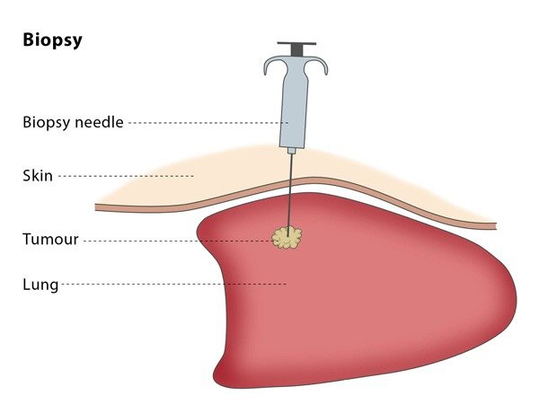 Varicose Veins Doctor in Jaipur, Spider Veins Specialist in Jaipur, Best Thyroid Ablation Specialist in Jaipur, Uterine Fibroid Treatment in Jaipur, Fibroids Surgeon in Jaipur, Dr Manish Rajput, ED Specialist Jaipur