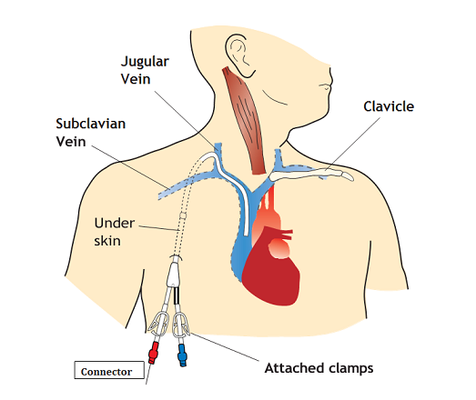 Varicose Veins Doctor in Jaipur, Spider Veins Specialist in Jaipur, Best Thyroid Ablation Specialist in Jaipur, Uterine Fibroid Treatment in Jaipur, Fibroids Surgeon in Jaipur, Dr Manish Rajput, ED Specialist Jaipur