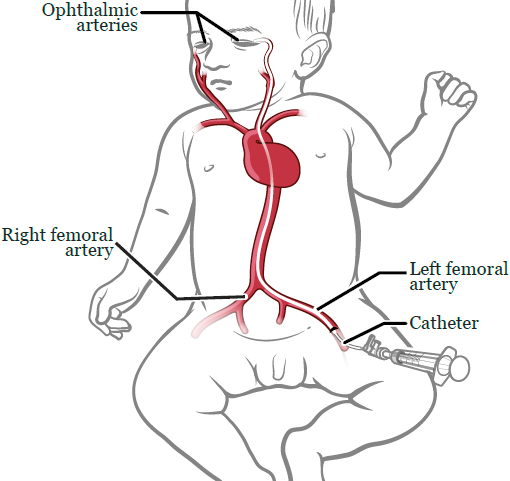 Varicose Veins Doctor in Jaipur, Spider Veins Specialist in Jaipur, Best Thyroid Ablation Specialist in Jaipur, Uterine Fibroid Treatment in Jaipur, Fibroids Surgeon in Jaipur, Dr Manish Rajput, ED Specialist Jaipur