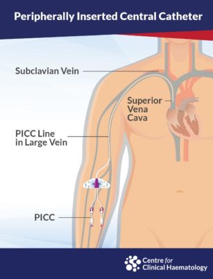 Varicose Veins Doctor in Jaipur, Spider Veins Specialist in Jaipur, Best Thyroid Ablation Specialist in Jaipur, Uterine Fibroid Treatment in Jaipur, Fibroids Surgeon in Jaipur, Dr Manish Rajput, ED Specialist Jaipur