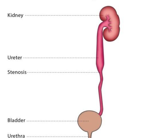 Varicose Veins Doctor in Jaipur, Spider Veins Specialist in Jaipur, Best Thyroid Ablation Specialist in Jaipur, Uterine Fibroid Treatment in Jaipur, Fibroids Surgeon in Jaipur, Dr Manish Rajput, ED Specialist Jaipur