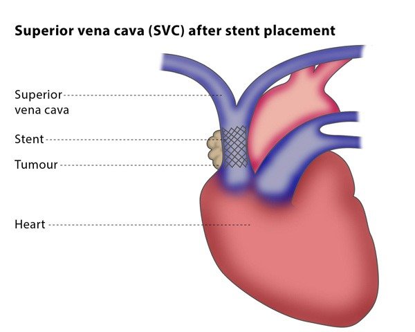 Varicose Veins Doctor in Jaipur, Spider Veins Specialist in Jaipur, Best Thyroid Ablation Specialist in Jaipur, Uterine Fibroid Treatment in Jaipur, Fibroids Surgeon in Jaipur, Dr Manish Rajput, ED Specialist Jaipur