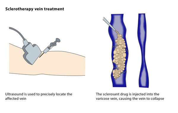 Varicose Veins Doctor in Jaipur, Spider Veins Specialist in Jaipur, Best Thyroid Ablation Specialist in Jaipur, Uterine Fibroid Treatment in Jaipur, Fibroids Surgeon in Jaipur, Dr Manish Rajput, ED Specialist Jaipur