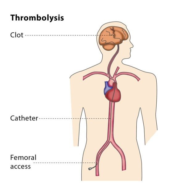 Varicose Veins Doctor in Jaipur, Spider Veins Specialist in Jaipur, Best Thyroid Ablation Specialist in Jaipur, Uterine Fibroid Treatment in Jaipur, Fibroids Surgeon in Jaipur, Dr Manish Rajput, ED Specialist Jaipur