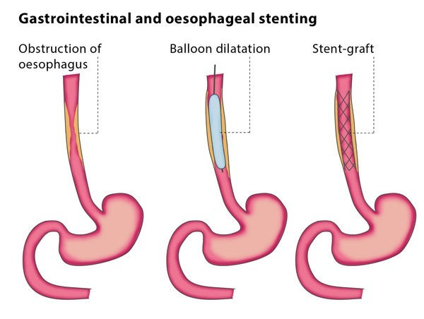 Varicose Veins Doctor in Jaipur, Spider Veins Specialist in Jaipur, Best Thyroid Ablation Specialist in Jaipur, Uterine Fibroid Treatment in Jaipur, Fibroids Surgeon in Jaipur, Dr Manish Rajput, ED Specialist Jaipur