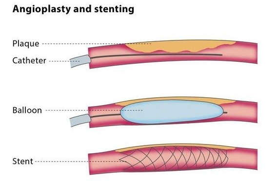 Varicose Veins Doctor in Jaipur, Spider Veins Specialist in Jaipur, Best Thyroid Ablation Specialist in Jaipur, Uterine Fibroid Treatment in Jaipur, Fibroids Surgeon in Jaipur, Dr Manish Rajput, ED Specialist Jaipur