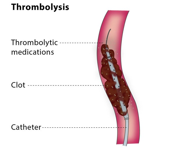 Varicose Veins Doctor in Jaipur, Spider Veins Specialist in Jaipur, Best Thyroid Ablation Specialist in Jaipur, Uterine Fibroid Treatment in Jaipur, Fibroids Surgeon in Jaipur, Dr Manish Rajput, ED Specialist Jaipur