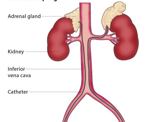 Varicose Veins Doctor in Jaipur, Spider Veins Specialist in Jaipur, Best Thyroid Ablation Specialist in Jaipur, Uterine Fibroid Treatment in Jaipur, Fibroids Surgeon in Jaipur, Dr Manish Rajput, ED Specialist Jaipur