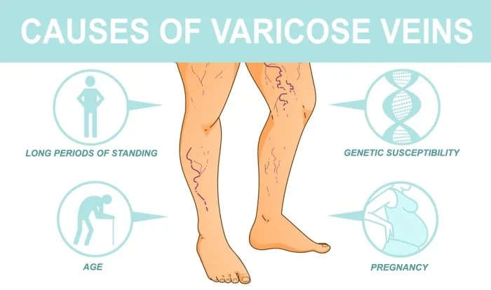 Varicose Veins Doctor in Jaipur, Spider Veins Specialist in Jaipur, Best Thyroid Ablation Specialist in Jaipur, Uterine Fibroid Treatment in Jaipur, Fibroids Surgeon in Jaipur, Dr Manish Rajput, ED Specialist Jaipur