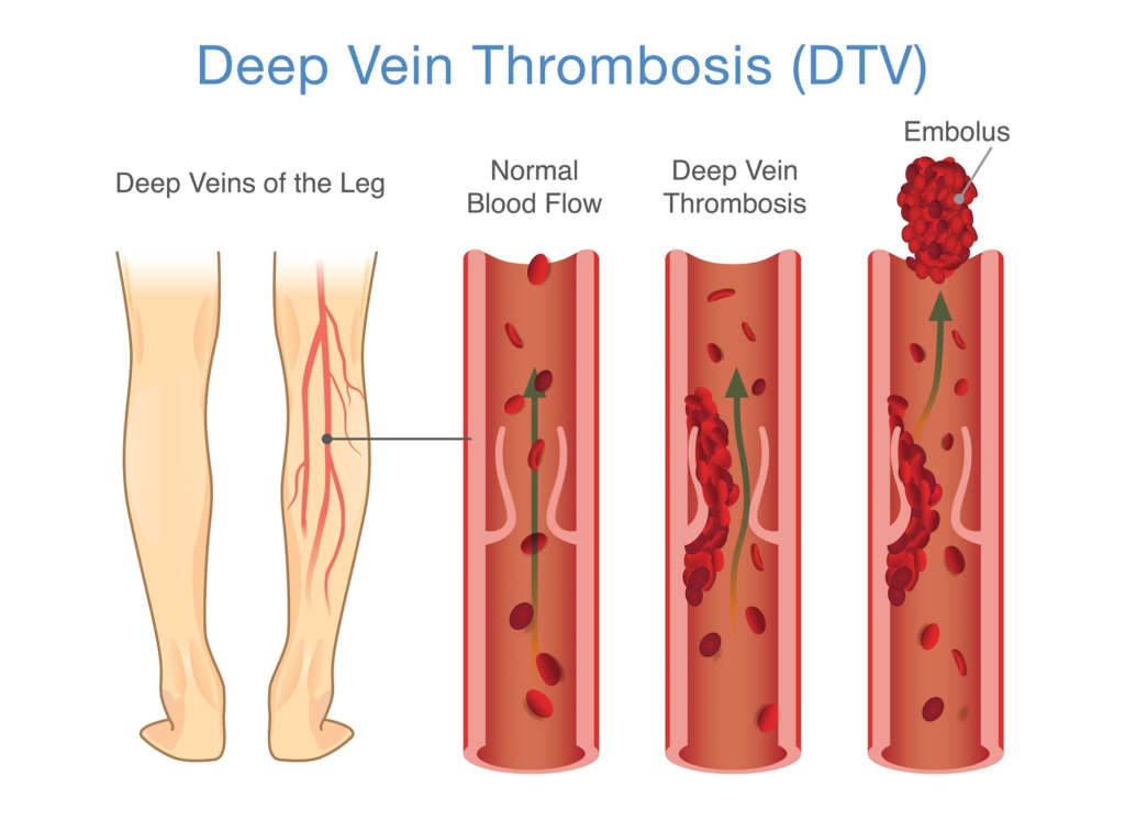 Varicose Veins Doctor in Jaipur, Spider Veins Specialist in Jaipur, Best Thyroid Ablation Specialist in Jaipur, Uterine Fibroid Treatment in Jaipur, Fibroids Surgeon in Jaipur, Dr Manish Rajput, ED Specialist Jaipur