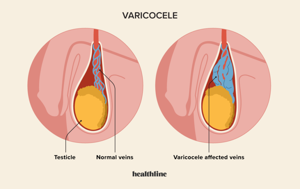 Varicose Veins Doctor in Jaipur, Spider Veins Specialist in Jaipur, Best Thyroid Ablation Specialist in Jaipur, Uterine Fibroid Treatment in Jaipur, Fibroids Surgeon in Jaipur, Dr Manish Rajput, ED Specialist Jaipur