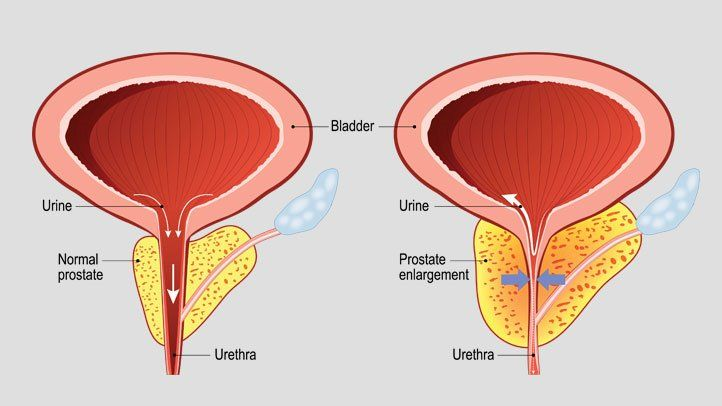 Varicose Veins Doctor in Jaipur, Spider Veins Specialist in Jaipur, Best Thyroid Ablation Specialist in Jaipur, Uterine Fibroid Treatment in Jaipur, Fibroids Surgeon in Jaipur, Dr Manish Rajput, ED Specialist Jaipur