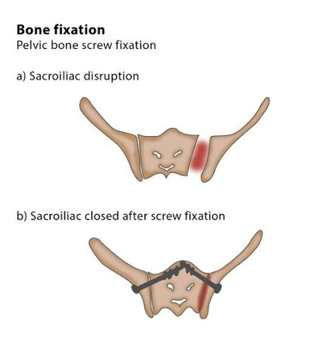 Varicose Veins Doctor in Jaipur, Spider Veins Specialist in Jaipur, Best Thyroid Ablation Specialist in Jaipur, Uterine Fibroid Treatment in Jaipur, Fibroids Surgeon in Jaipur, Dr Manish Rajput, ED Specialist Jaipur